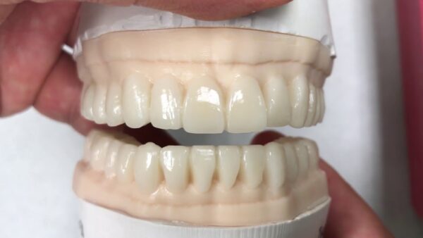 Dentition - Image 3