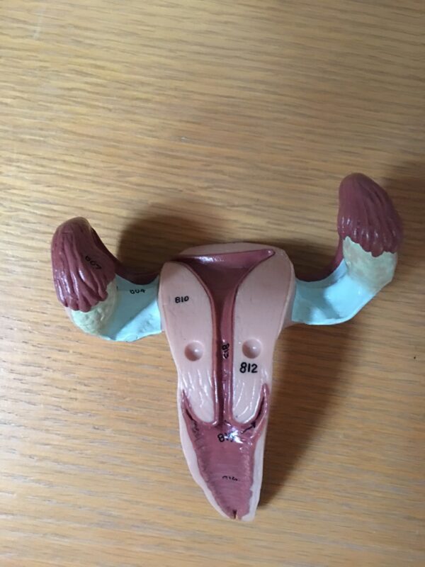 Uterus - Image 2