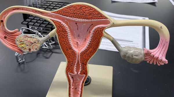 Uterus - Image 3